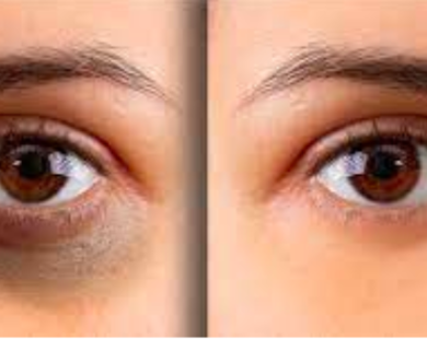 3 thao tác xoa bóp tự nhiên giúp giảm thâm quầng mắt dễ làm mà hiệu quả